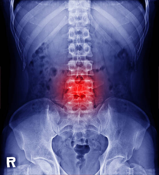 пленка рентгеновского межпозвонкового поясничного отдела позвоночника и таза - human skeleton body the human body pain стоковые фото и изображения