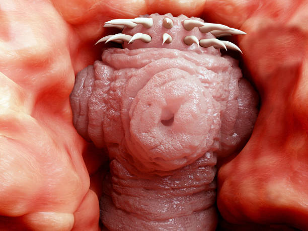 head of a tapeworm attached to the wall of a human intestine - food hygiene imagens e fotografias de stock