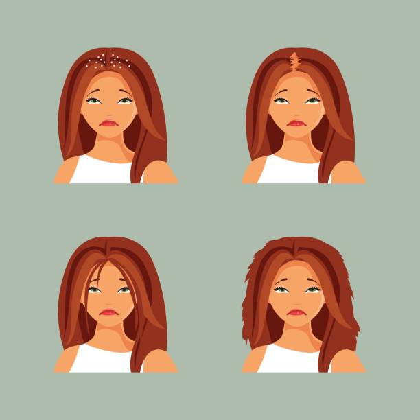 Hair Problem Animation 1,700+ Messed Up Hair Stock Illustrations, Royalty-Free Vector Graphics ...