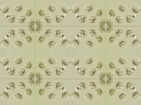 Gram-negative, rod-shaped bacteria are a type of bacteria characterized by their appearance under a microscope and their cell wall structure. They have a thin peptidoglycan layer sandwiched between two lipid membranes, which makes them more resistant to certain antibiotics compared to Gram-positive bacteria. Common examples include Escherichia coli (E. coli), Salmonella, and Pseudomonas aeruginosa. These bacteria can cause a wide range of infections in humans, ranging from mild gastrointestinal illnesses to severe systemic infections, and they play significant roles in both environmental and clinical settings.