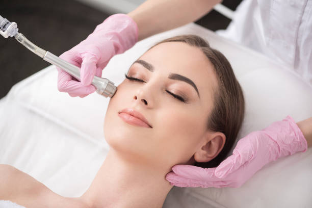 Pleasant young woman is resting in spa Pleasure time. Close-up top-view portrait of girl, which is lying on table with closed eyes and getting microdermabrasion skin treatment at beauty salon microdermabrasion stock pictures, royalty-free photos & images