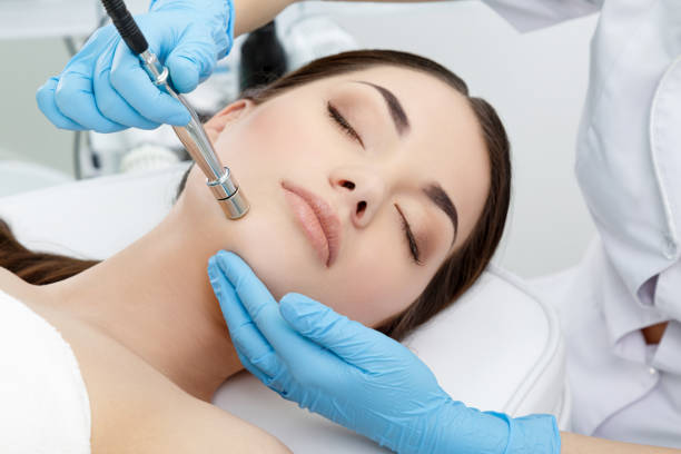 Procedure of Microdermabrasion stock photo