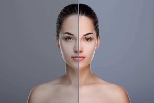 istock Comparison portrait with acne and retouch 804259762
