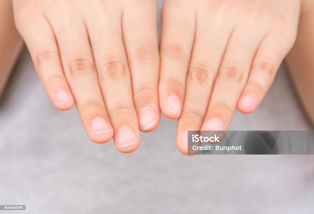 Cuatro Dedos En Una Mano Derecha Uñas Largas Y Sucias Cuatro Dedos A La  Izquierda Con Las Uñas Cortas Y Limpias Los Niños Deben Cortar Uñas Cortas  Y Limpias Mantener Buena Higiene