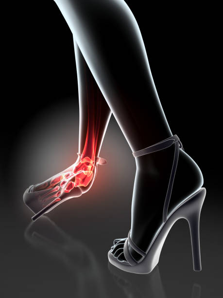 istock Ankle painful - skeleton x-ray. 805551192