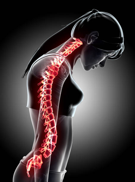 istock 3D Illustration of sacral and cervical painful. 805552924