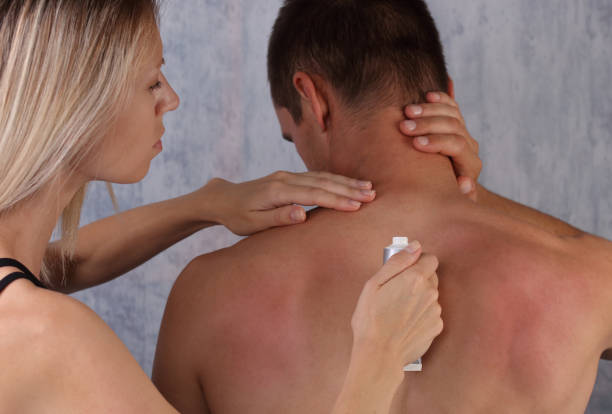 istock Sun protection. Man suffering from sunburn. ,woman applying sunburn lotion on man's back 805750182
