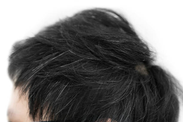 istock young man with gray hair on his head 806038272