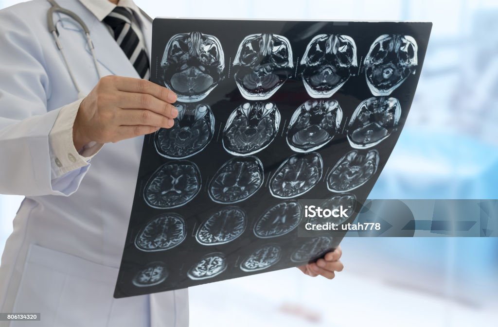 doctor medical Doctor diagnose EEG image of brain patient at operating room in hospital. medical brain concept. Stroke - Illness Stock Photo