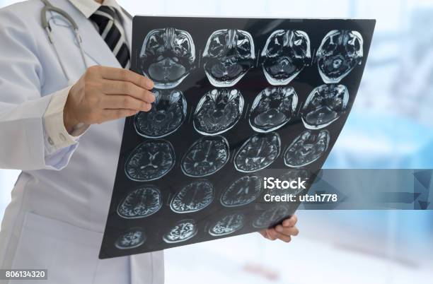 Doctor Medical Stock Photo - Download Image Now - Stroke - Illness, Neurologist, Patient