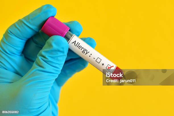 Allergy Positive Stock Photo - Download Image Now - Allergy Test, Analyzing, Blood