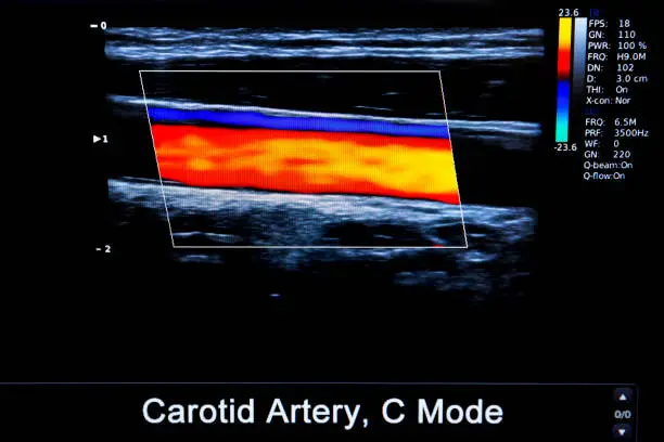 Photo of Colourful image of modern ultrasound monitor