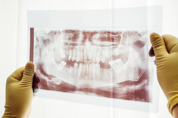 istock Panoramic scan of dental mutation closeup 807150316