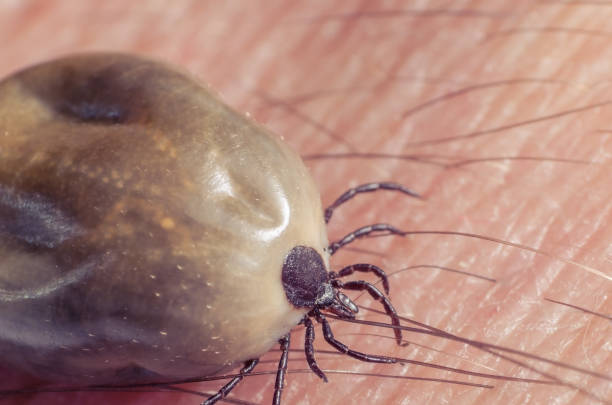istock Tick filled with blood sitting on human skin 807784678