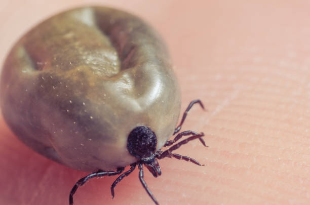 istock Tick filled with blood sitting on human skin 807784726
