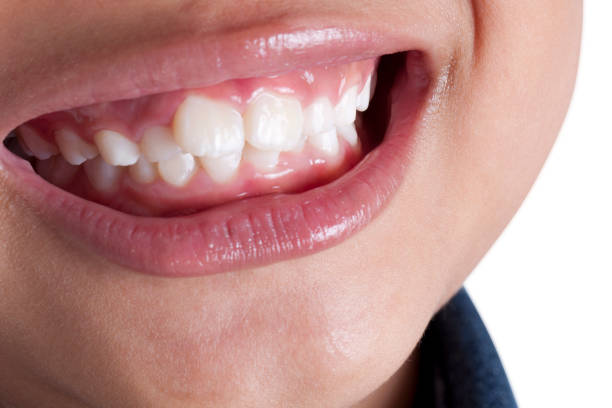 istock close-up photo of a boy smiling. 807994536