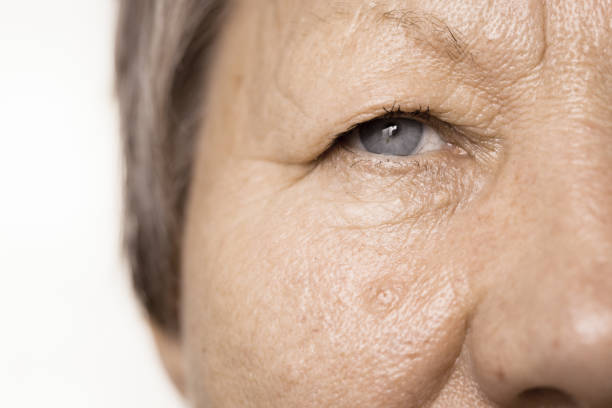 istock Elderly pensioner female half face portrait closeup 808460866