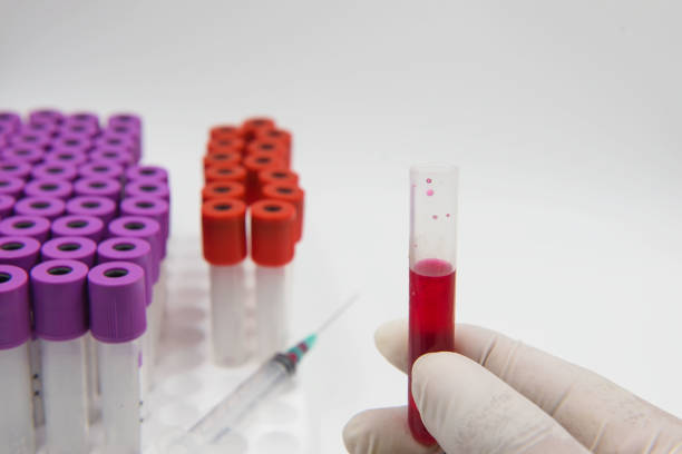 istock sample blood tube in hand and syringe on a white background. 808503122