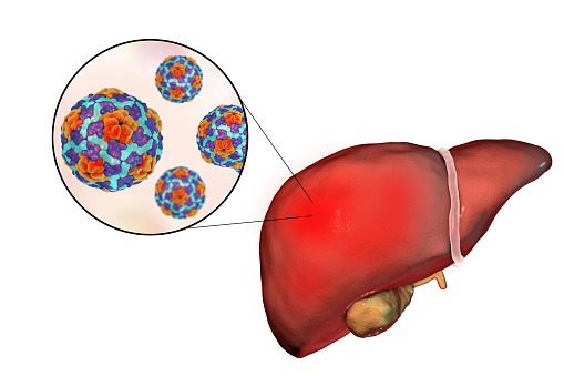 Liver with Hepatitis A infection and close-up view of Hepatitis A Virus, 3D illustration