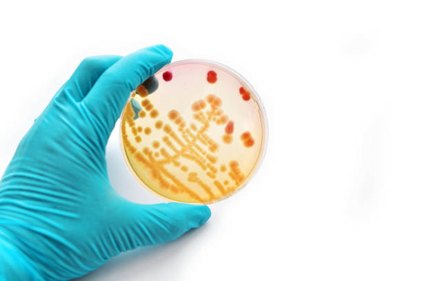 バクテリアの文化 - agar jelly medical sample bacterium microbiology ストックフォトと画像