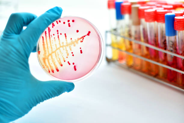 バクテリアの文化 - agar jelly medical sample bacterium microbiology ストックフォトと画像