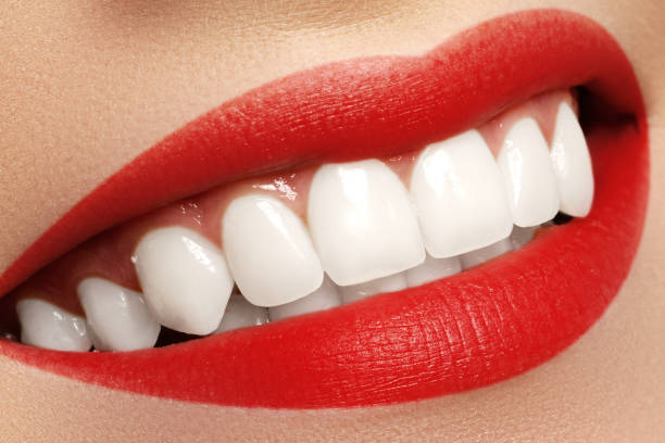 istock Macro happy woman's smile with healthy white teeth. Lips make-up 809924616