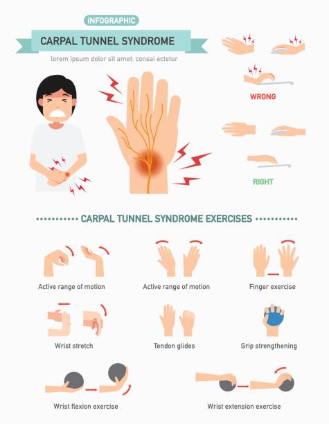 infografika zespołu cieśni nadgarstka, wektor - wrong injury stock illustrations