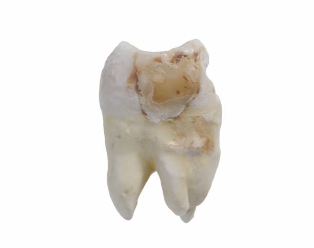 istock Dental concept, mouth mirror and tooth, 3D illustration 810692962