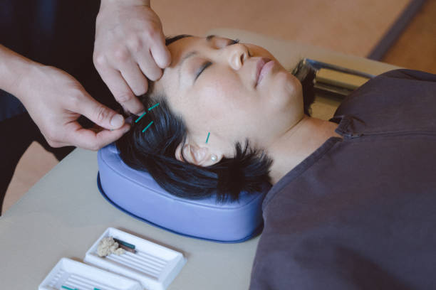 istock Patient receiving acupuncture treatment 810752628