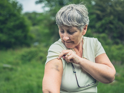 A senior woman in nature is looking at a bruise on her arm