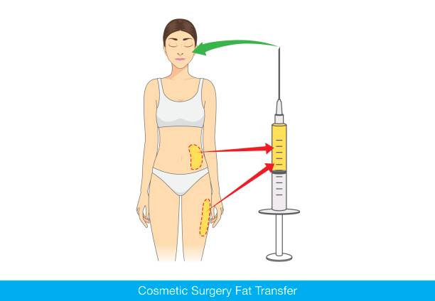 ilustraciones, imágenes clip art, dibujos animados e iconos de stock de belleza mujer hacer transferencia de grasa del cuerpo para facial. - naked women human leg body