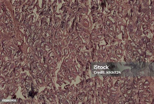 Human Cells Under The Microscope Stock Photo - Download Image Now - Anatomy, Biological Cell, Biology