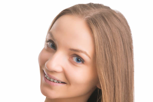 istock Face Closeup of Smiling Young Caucasian Blond With Teeth Brackets. 811036940