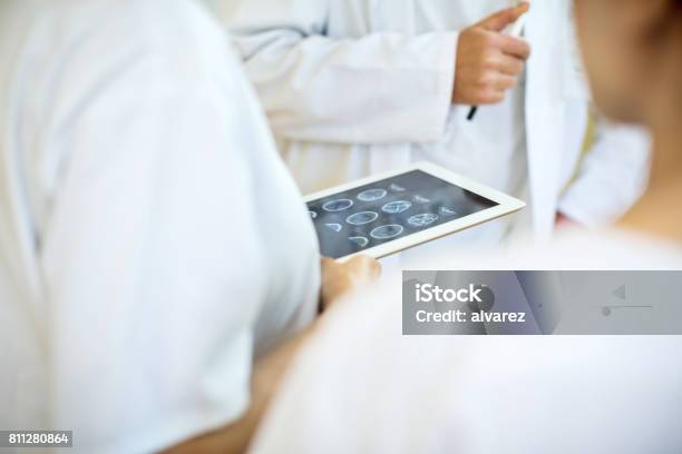 Team Von Ärzten Die Analyse Von Mri Scans Auf Digitaltablette Stockfoto und mehr Bilder von Tablet PC