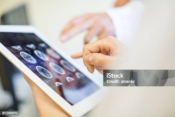 Medizinisches Team Analysieren Mri Scans Auf Digitaltablette Stockfoto und mehr Bilder von Gesundheitswesen und Medizin