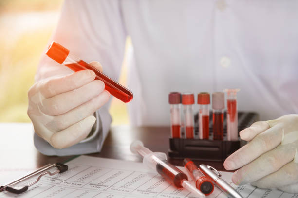 scientifique, tenir le tube avec l’échantillon de sang - scientist research test tube lab coat photos et images de collection