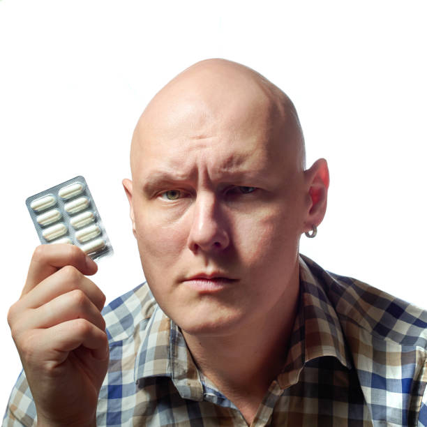 istock Autoimmune total alopecia men portrait. Absolute bald head without eyebrows 812417074