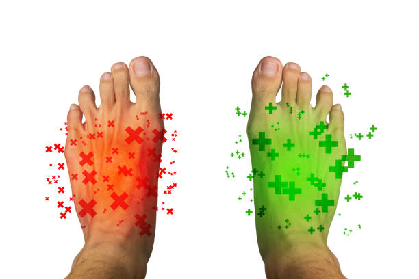 istock Man's feet with concept Injury and treatment 812981010