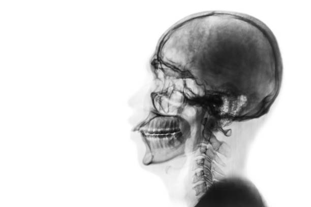 istock X-ray normal skull and cervical spine . Lateral view . Invert color style . 813062308