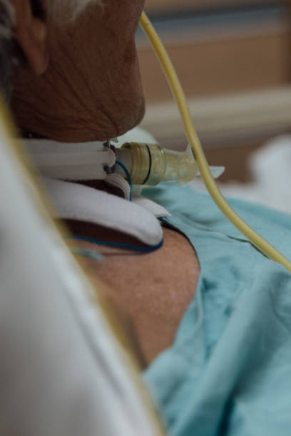 患者アジア長老女性 80 年代は、病院のベッド上のヘルプを呼吸のため気管カニューレ使用ベンチレーターを行います。 - pulmonary valve ストックフォトと画像