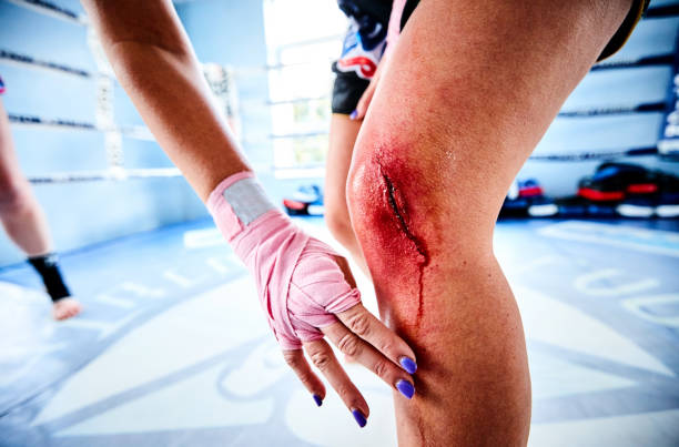 Female fighter with injured knee in gym Woman fighter with injured knee suffering pain during fight. Close up of female with knee cut during kickboxing practice in gym. knee contusion bruised knee stock pictures, royalty-free photos & images