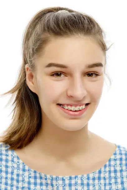 Portrait of Caucasian teenage girl with broad smile showing dental braces.Isolated on white background.