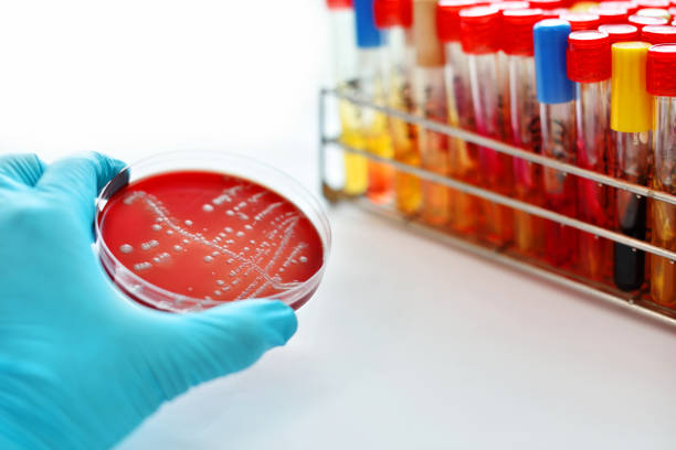 バクテリアの文化 - agar jelly medical sample bacterium microbiology ストックフォトと画像