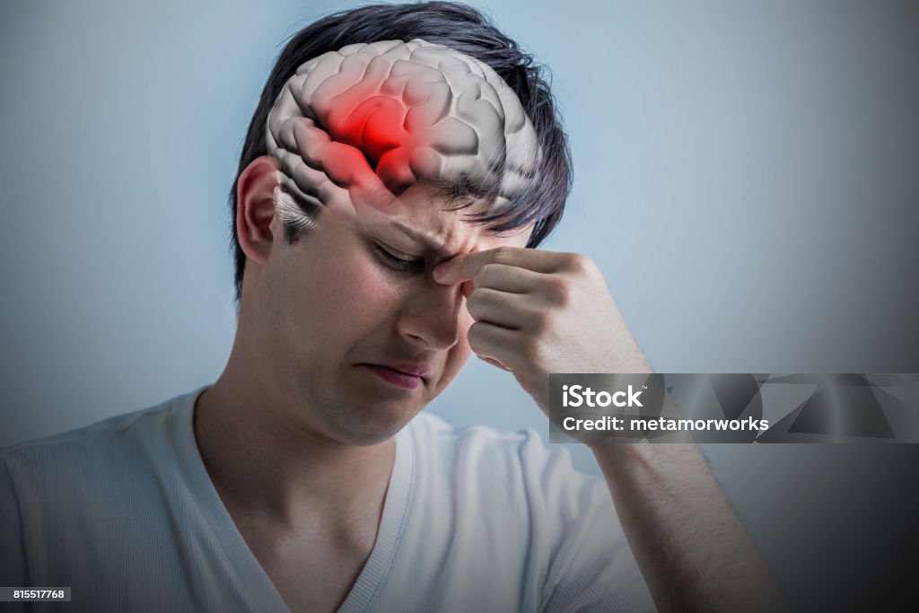 brain stroke concept, headache, cerebral hemorrhage, 3D rendering Stroke - Illness Stock Photo