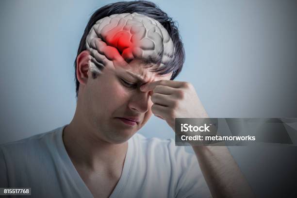 Brain Stroke Concept Headache Cerebral Hemorrhage 3d Rendering Stock Photo - Download Image Now