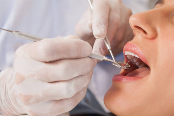 istock Dentist examining a patients teeth in the dentists chair 816159370