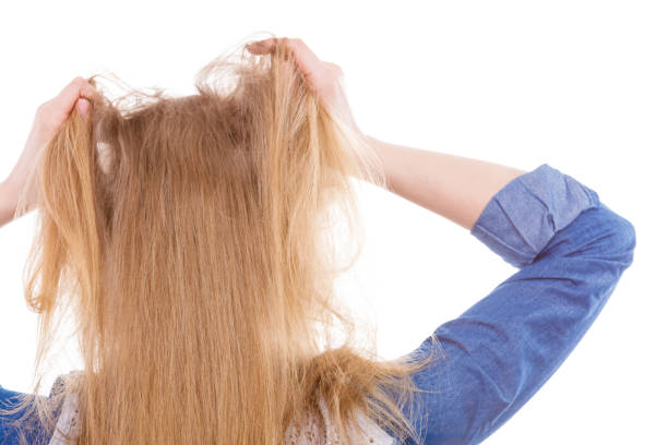 istock Furious woman pull hair out of head. 816159906