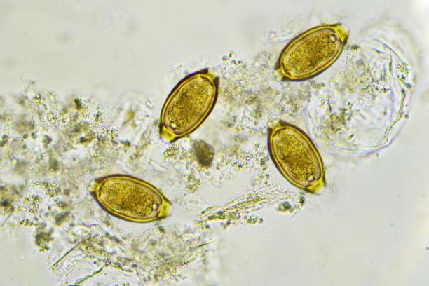 istock Trichuris trichiura (whipworm) 816339342