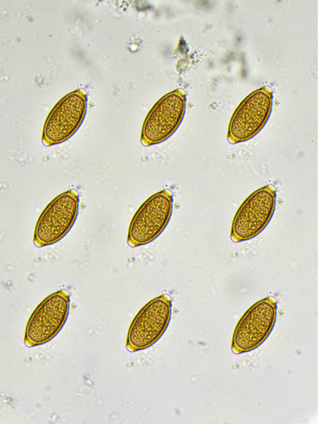 istock Trichuris trichiura (whipworm) 816339354