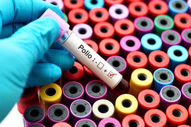 Polio positive Blood sample positive with polio virus polio photos stock pictures, royalty-free photos & images